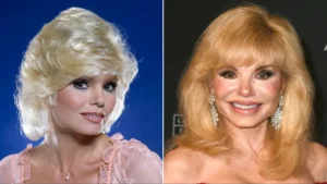 Loni Anderson