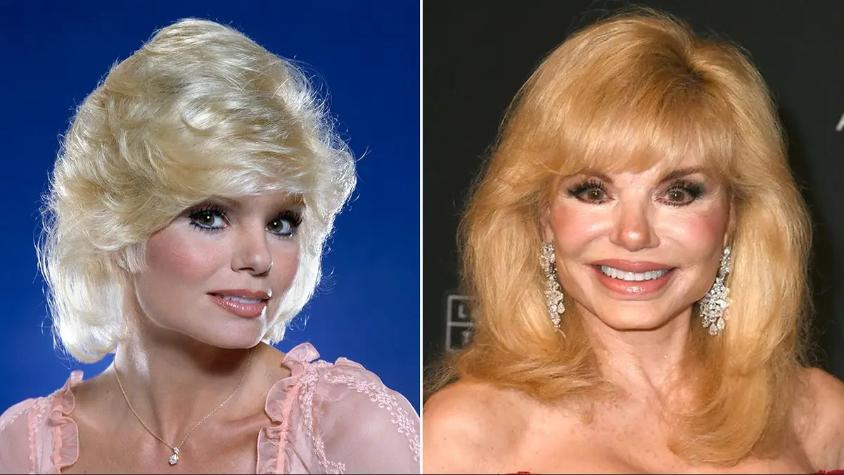 Loni Anderson